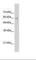 SLC22A1 Antibody - Jurkat Cell Lysate.  This image was taken for the unconjugated form of this product. Other forms have not been tested.