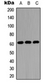 SLC22A1 Antibody - Western blot analysis of 42278 expression in A549 (A); NS-1 (B); H9C2 (C) whole cell lysates.