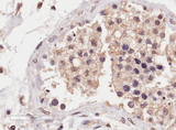 SLC22A16 Antibody - Goat Anti-SLC22A16 Antibody (4?/ml) staining of paraffin embedded Human Testis. Microwaved antigen retrieval with Tris/EDTA buffer pH9, HRP-staining.