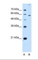 SLC22A2 Antibody - Lane A: Marker. Lane B: HepG2 cell lysate. Antibody concentration: 2.5 ug/ml. Gel concentration: 12%.  This image was taken for the unconjugated form of this product. Other forms have not been tested.
