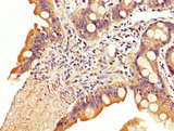 SLC22A23 Antibody - Immunohistochemistry image at a dilution of 1:200 and staining in paraffin-embedded human small intestine tissue performed on a Leica BondTM system. After dewaxing and hydration, antigen retrieval was mediated by high pressure in a citrate buffer (pH 6.0) . Section was blocked with 10% normal goat serum 30min at RT. Then primary antibody (1% BSA) was incubated at 4 °C overnight. The primary is detected by a biotinylated secondary antibody and visualized using an HRP conjugated SP system.