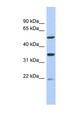 SLC22A24 Antibody - SLC22A24 antibody Western blot of 293T cell lysate. This image was taken for the unconjugated form of this product. Other forms have not been tested.