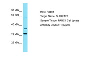 SLC22A25 Antibody -  This image was taken for the unconjugated form of this product. Other forms have not been tested.