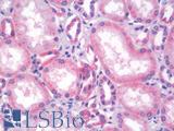 SLC22A3 / OCT3 Antibody - Human Kidney: Formalin-Fixed, Paraffin-Embedded (FFPE)