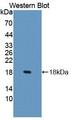 SLC22A4 / OCTN1 Antibody - Western blot of SLC22A4 / OCTN1 antibody.