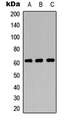 SLC22A4 / OCTN1 Antibody - Western blot analysis of OCTN1 expression in MCF7 (A); NS-1 (B); PC12 (C) whole cell lysates.