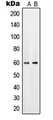 SLC22A6 / OAT1 Antibody - Western blot analysis of PAHT expression in HeLa (A); mouse brain (B) whole cell lysates.