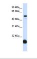 SLC22A7 / OAT2 Antibody - Fetal liver lysate. Antibody concentration: 1.0 ug/ml. Gel concentration: 12%.  This image was taken for the unconjugated form of this product. Other forms have not been tested.