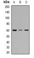 SLC22A8 / OAT3 Antibody - Western blot analysis of OAT3 expression in HEK293T (A); HepG2 (B); SW480 (C) whole cell lysates.