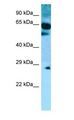 SLC22A9 / OAT7 Antibody - SLC22A9 / OAT7 antibody Western Blot of Fetal Heart.  This image was taken for the unconjugated form of this product. Other forms have not been tested.
