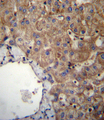 SLC23A1 / SVCT1 Antibody - SLC23A1 Antibody immunohistochemistry of formalin-fixed and paraffin-embedded human liver tissue followed by peroxidase-conjugated secondary antibody and DAB staining.