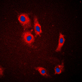 SLC24A1 / NCKX Antibody - Immunofluorescent analysis of NCKX1 staining in HeLa cells. Formalin-fixed cells were permeabilized with 0.1% Triton X-100 in TBS for 5-10 minutes and blocked with 3% BSA-PBS for 30 minutes at room temperature. Cells were probed with the primary antibody in 3% BSA-PBS and incubated overnight at 4 C in a humidified chamber. Cells were washed with PBST and incubated with a DyLight 594-conjugated secondary antibody (red) in PBS at room temperature in the dark. DAPI was used to stain the cell nuclei (blue).