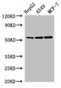 SLC24A5 / NCKX5 Antibody - Western Blot Positive WB detected in:HepG2 whole cell lysate,A549 whole cell lysate,MCF-7 whole cell lysate All Lanes:SLC24A5 antibody at 2.5µg/ml Secondary Goat polyclonal to rabbit IgG at 1/50000 dilution Predicted band size: 55,49 KDa Observed band size: 55 KDa