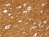 SLC25A13 / CITRIN Antibody - Immunohistochemistry of paraffin-embedded Human brain using SLC25A13 Polyclonal Antibody at dilution of 1:35.