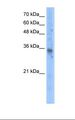 SLC25A16 / GDA / Graves Antibody - Transfected 293T cell lysate. Antibody concentration: 5.0 ug/ml. Gel concentration: 12%.  This image was taken for the unconjugated form of this product. Other forms have not been tested.