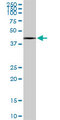 SLC25A16 / GDA / Graves Antibody - SLC25A16 monoclonal antibody (M01), clone 1H7. Western Blot analysis of SLC25A16 expression in HeLa.