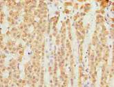 SLC25A18 Antibody - Immunohistochemistry of paraffin-embedded human adrenal gland tissue using antibody at dilution of 1:100.