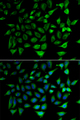 SLC25A20 / CACT Antibody - Immunofluorescence analysis of HeLa cells.