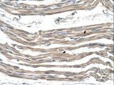 SLC25A22 / GC1 Antibody - SLC25A22 antibody ARP44041_T100-NP_078974-SLC25A22(solute carrier family 25 (mitochondrial carrier: glutamate), member 22) Antibody was used in IHC to stain formalin-fixed, paraffin-embedded human muscle.  This image was taken for the unconjugated form of this product. Other forms have not been tested.