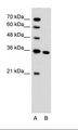 SLC25A29 Antibody - A: Marker, B: Jurkat Cell Lysate.  This image was taken for the unconjugated form of this product. Other forms have not been tested.