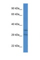 SLC25A31 Antibody - SLC25A31 antibody Western blot of Mouse Heart lysate. Antibody concentration 1 ug/ml. This image was taken for the unconjugated form of this product. Other forms have not been tested.