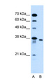 SLC25A32 Antibody - SLC25A32 antibody ARP44049_P050-NP_110407-SLC25A32(solute carrier family 25, member 32) Antibody Western blot of HepG2 cell lysate.  This image was taken for the unconjugated form of this product. Other forms have not been tested.
