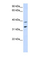 SLC25A34 Antibody - SLC25A34 antibody Western blot of Placenta lysate. This image was taken for the unconjugated form of this product. Other forms have not been tested.
