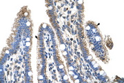 SLC25A39 Antibody - SLC25A39 antibody ARP43962_P050-NP_057100-SLC25A39(solute carrier family 25, member 39) Antibody IHC of formalin-fixed, paraffin-embedded human Intestine. Positive label: Epithelial cells of intestinal villus indicated with arrows. Antibody concentration 4-8 ug/ml. Magnification 400X.  This image was taken for the unconjugated form of this product. Other forms have not been tested.