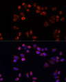 SLC25A4 / ANT Antibody - Immunofluorescence analysis of HeLa cells using SLC25A4 antibody at dilution of 1:100 (40x lens). Blue: DAPI for nuclear staining.