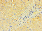 SLC25A40 Antibody - Immunohistochemistry of paraffin-embedded human liver tissue using SLC25A40 Antibody at dilution of 1:100