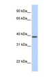 SLC25A42 Antibody - SLC25A42 antibody Western blot of Fetal Muscle lysate. This image was taken for the unconjugated form of this product. Other forms have not been tested.