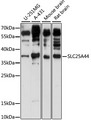 SLC25A44 Antibody - Western blot analysis of extracts of various cell lines, using SLC25A44 antibody at 1:1000 dilution. The secondary antibody used was an HRP Goat Anti-Rabbit IgG (H+L) at 1:10000 dilution. Lysates were loaded 25ug per lane and 3% nonfat dry milk in TBST was used for blocking. An ECL Kit was used for detection and the exposure time was 30s.