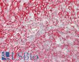 SLC26A1 Antibody - Human Tonsil: Formalin-Fixed, Paraffin-Embedded (FFPE)