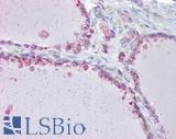 SLC26A4 / Pendrin Antibody - Human Thyroid: Formalin-Fixed, Paraffin-Embedded (FFPE).  This image was taken for the unconjugated form of this product. Other forms have not been tested.