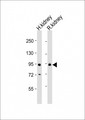 SLC26A4 / Pendrin Antibody - All lanes: Anti-SLC26A4 Antibody (C-Term) at 1:2000 dilution. Lane 1: human kidney lysate. Lane 2: rat kidney lysate Lysates/proteins at 20 ug per lane. Secondary Goat Anti-Rabbit IgG, (H+L), Peroxidase conjugated at 1:10000 dilution. Predicted band size: 86 kDa. Blocking/Dilution buffer: 5% NFDM/TBST.