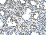 SLC26A5 Antibody - SLC26A5 antibody SLC26A5(solute carrier family 26, member 5 (prestin)) Antibody was used in IHC to stain formalin-fixed, paraffin-embedded human lung.  This image was taken for the unconjugated form of this product. Other forms have not been tested.