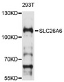 SLC26A6 / PAT1 Antibody - Western blot analysis of extracts of 293T cells, using SLC26A6 antibody at 1:1000 dilution. The secondary antibody used was an HRP Goat Anti-Rabbit IgG (H+L) at 1:10000 dilution. Lysates were loaded 25ug per lane and 3% nonfat dry milk in TBST was used for blocking. An ECL Kit was used for detection and the exposure time was 90s.