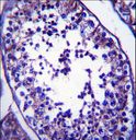 SLC27A3 Antibody - SLC27A3 Antibody immunohistochemistry of formalin-fixed and paraffin-embedded human testis tissue followed by peroxidase-conjugated secondary antibody and DAB staining.