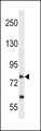 SLC28A2 Antibody - SLC28A2 Antibody western blot of A549 cell line lysates (35 ug/lane). The SLC28A2 antibody detected the SLC28A2 protein (arrow).