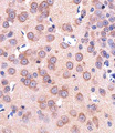 SLC29A1 / ENT1 Antibody - Immunohistochemical of paraffin-embedded R. brain section using ENT1(Slc29a1). Antibody was diluted at 1:25 dilution. A peroxidase-conjugated goat anti-rabbit IgG at 1:400 dilution was used as the secondary antibody, followed by DAB staining.