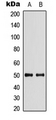 SLC29A2 / ENT2 Antibody - Western blot analysis of ENT2 expression in HEK293T (A); Raw264.7 (B) whole cell lysates.