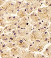 SLC29A2 / ENT2 Antibody - SLC29A2 Antibody (N-Term) staining SLC29A2 in human liver tissue sections by Immunohistochemistry (IHC-P - paraformaldehyde-fixed, paraffin-embedded sections). Tissue was fixed with formaldehyde and blocked with 3% BSA for 0. 5 hour at room temperature; antigen retrieval was by heat mediation with a citrate buffer (pH6). Samples were incubated with primary antibody (1/25) for 1 hours at 37°C. A undiluted biotinylated goat polyvalent antibody was used as the secondary antibody.