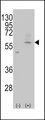 SLC29A4 Antibody - Western blot of PMAT(Slc29a4) (arrow) using rabbit polyclonal PMAT(Slc29a4) Antibody. 293 cell lysates (2 ug/lane) either nontransfected (Lane 1) or transiently transfected with the PMAT(Slc29a4) gene (Lane 2) (Origene Technologies).