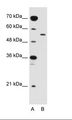 SLC2A10 / GLUT10 Antibody - A: Marker, B: Jurkat Cell Lysate.  This image was taken for the unconjugated form of this product. Other forms have not been tested.