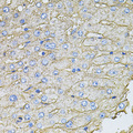 SLC2A2 / GLUT2 Antibody - Immunohistochemistry of paraffin-embedded human liver injury tissue.