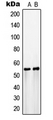 SLC2A3 / GLUT3 Antibody - Western blot analysis of GLUT3 expression in COLO205 (A); HepG2 (B) whole cell lysates.