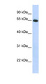 SLC2A4 / GLUT-4 Antibody - SLC2A4 / GLUT4 antibody Western blot of HepG2 cell lysate. This image was taken for the unconjugated form of this product. Other forms have not been tested.