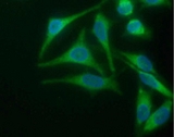 SLC2A4 / GLUT-4 Antibody - HeLa cells stained with Mouse anti-Glucose Transporter 4:FITC and counterstained with DAPI This image was taken for the unconjugated form of this product. Other forms have not been tested.