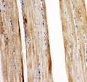 SLC2A5 / GLUT5 Antibody - IHC analysis of GLUT5 using anti-GLUT5 antibody. GLUT5 was detected in paraffin-embedded section of mouse ggj3249 tissues. Heat mediated antigen retrieval was performed in citrate buffer (pH6, epitope retrieval solution) for 20 mins. The tissue section was blocked with 10% goat serum. The tissue section was then incubated with 1µg/ml rabbit anti-GLUT5 Antibody overnight at 4°C. Biotinylated goat anti-rabbit IgG was used as secondary antibody and incubated for 30 minutes at 37°C. The tissue section was developed using Strepavidin-Biotin-Complex (SABC) with DAB as the chromogen.