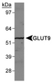SLC2A9 / GLUT9 Antibody - Detection of GLUT9 in human kidney membrane.  This image was taken for the unconjugated form of this product. Other forms have not been tested.